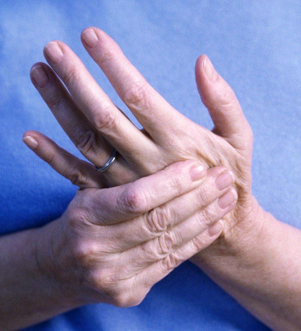 Rheumatoid Arthritis Treatment Delhi | DelhiPhysioCare