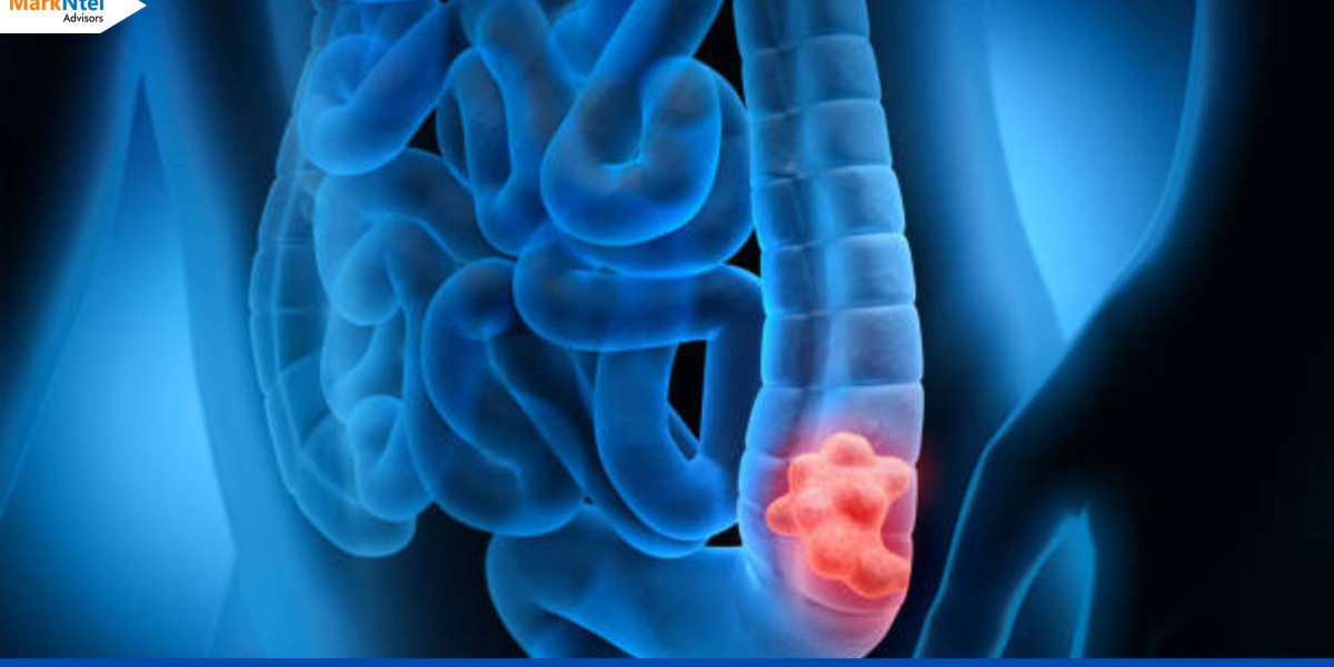 China Colorectal Cancer Treatment Market Forecast 2022-2027: Latest Trends, Leading Companies and industry Demand by 202