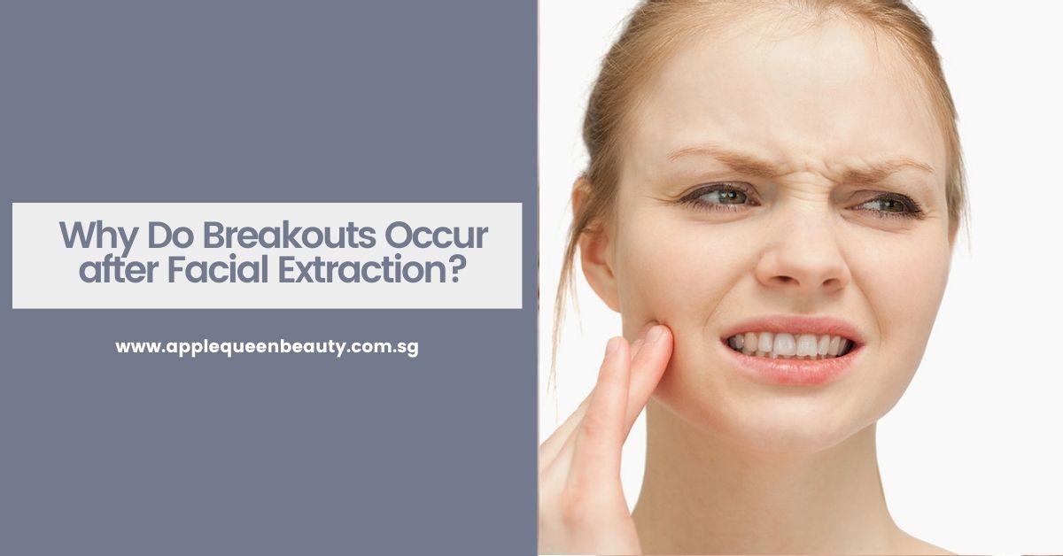 Why Do Breakouts Occur after Facial Extraction? Apple Beauty