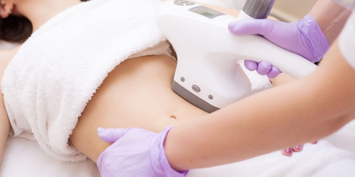 Fat Freezing for Women: Sculpt Your Ideal Shape