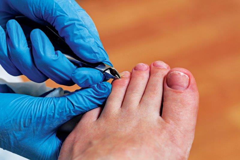Kick Fungus to the Curb: Understanding Onychomycosis Symptoms and Treatment Options - Plano | Specialty Care Clinics