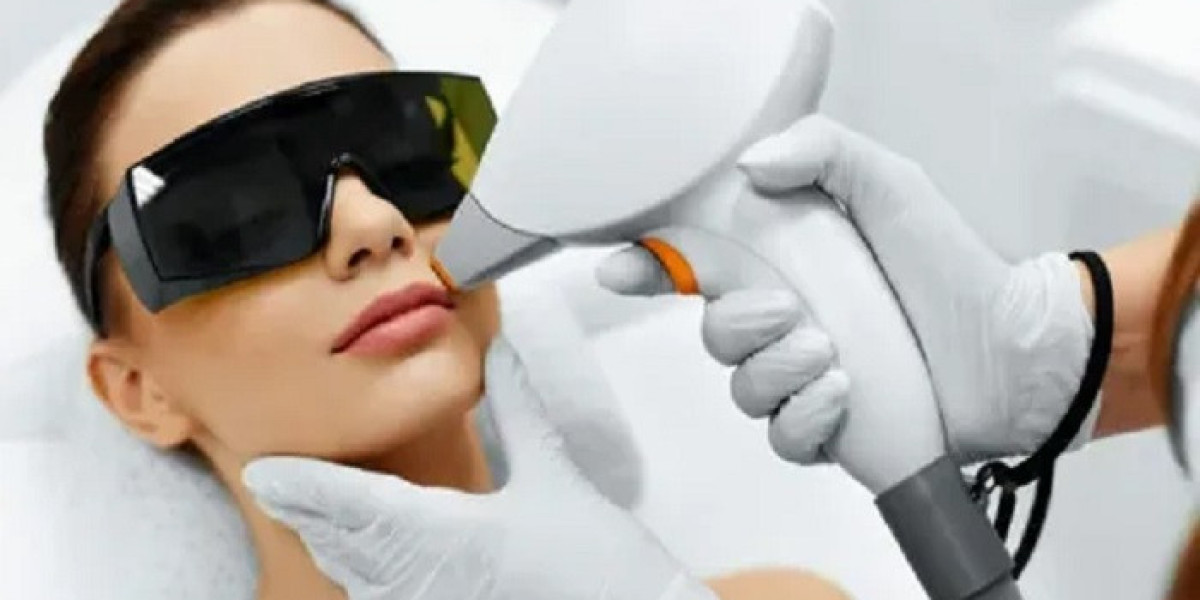 Laser Hair Removal in Riyadh: The Ultimate Guide to Long-Lasting Smooth Skin