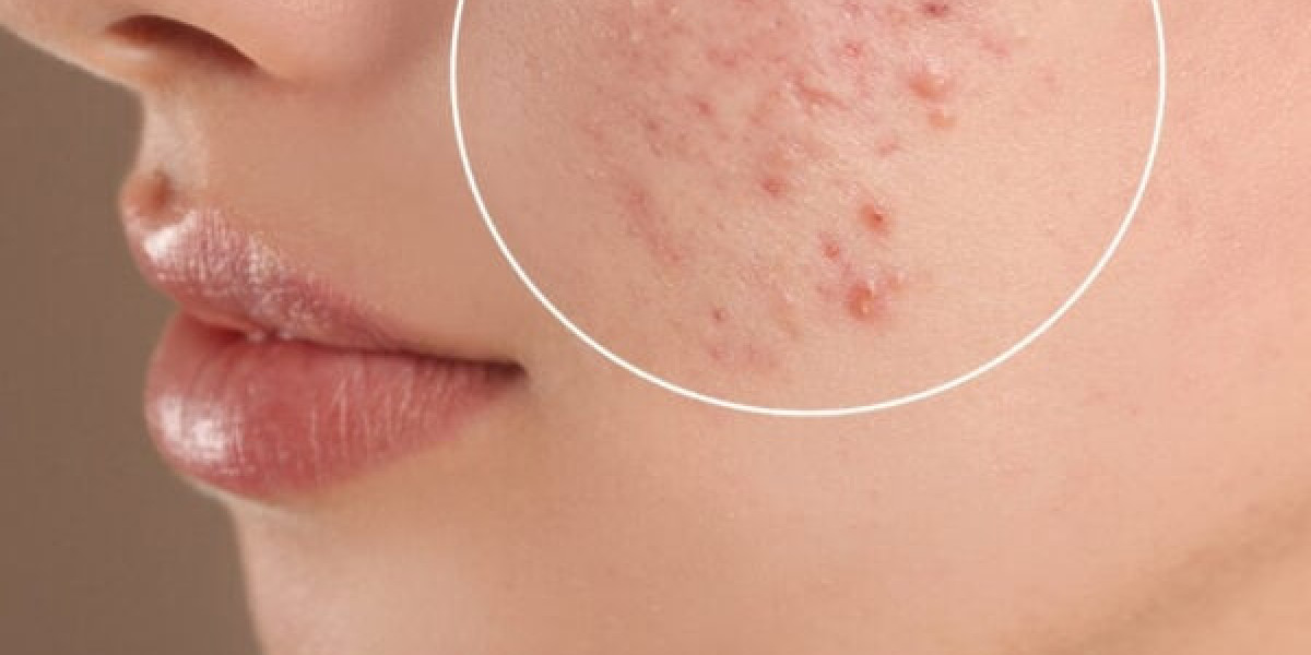 Most Recommended Scar Removal Creams of 2025