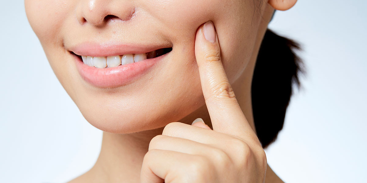 What to Avoid After Cheek Augmentation