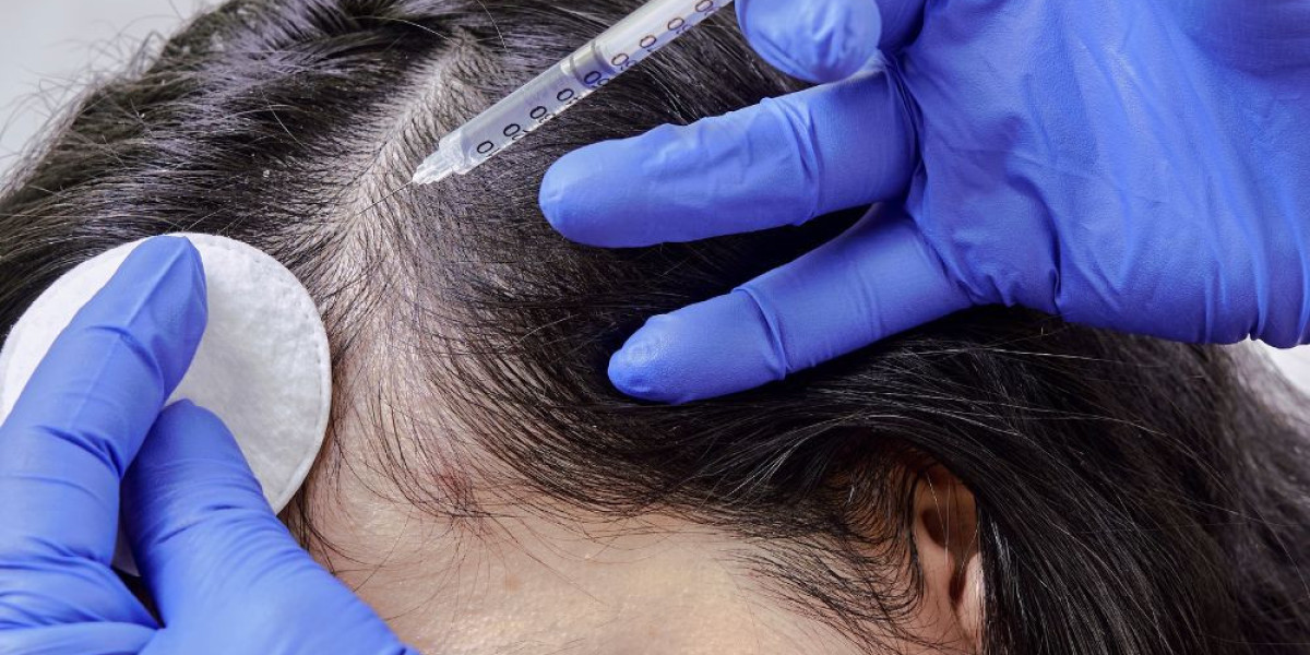 Regain Your Confidence with PRP Hair Treatment in Riyadh: The Natural Way to Restore Hair