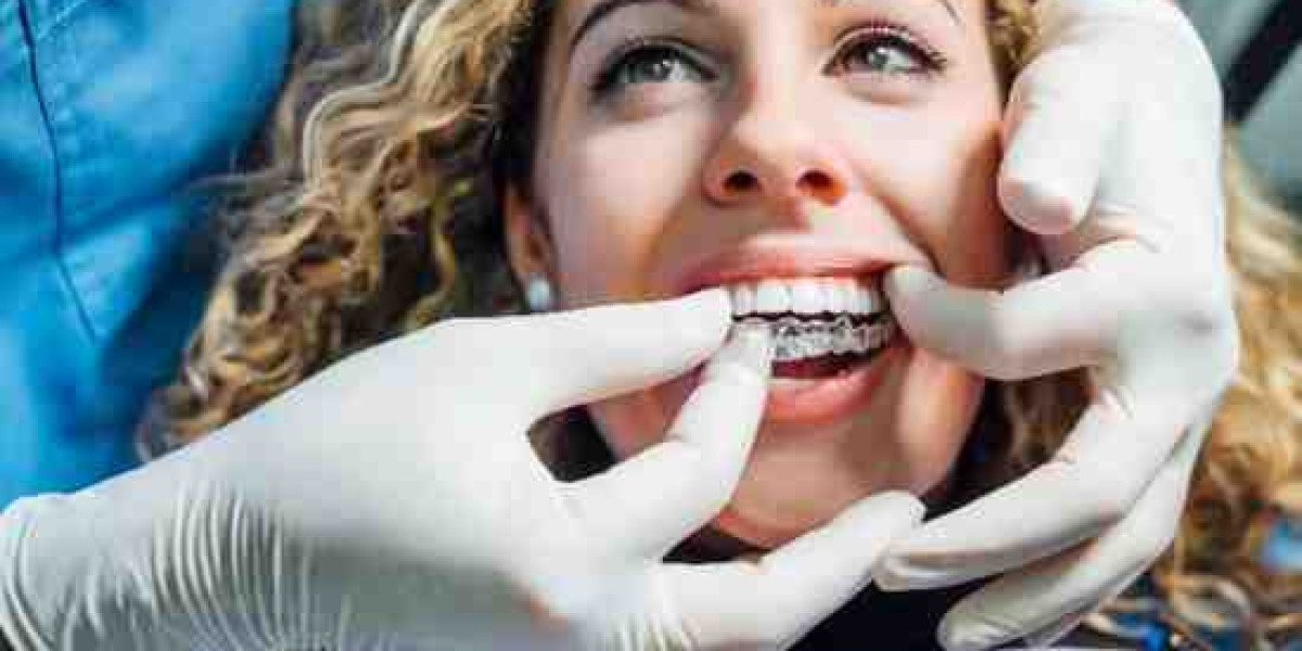 Invisible Aligners That Blend Seamlessly with Your Smile