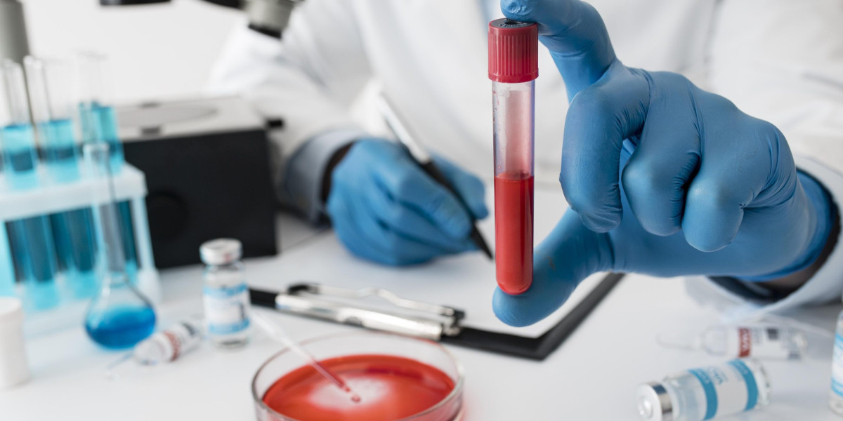 Convenient & Hassle-Free Blood Test at Home in Bengaluru | Book Now