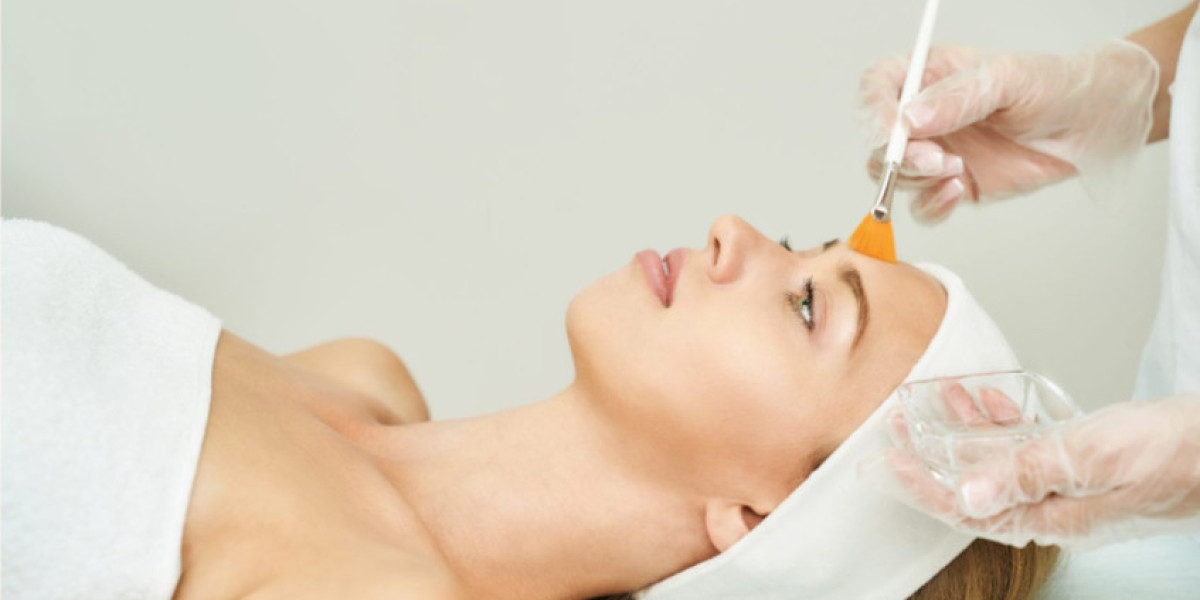 The Role of pH Levels in Chemical Peels in Islamabad