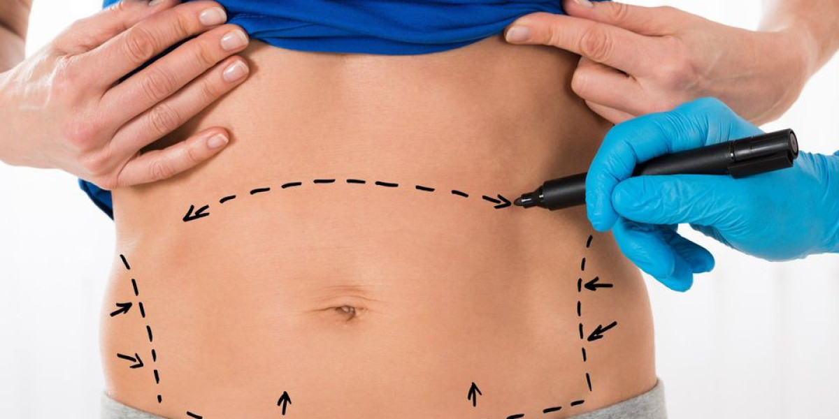 How Does Dubai Compare to Other Countries for Mini Tummy Tuck Safety?