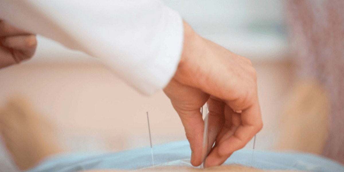 Acupuncture Therapy NYC