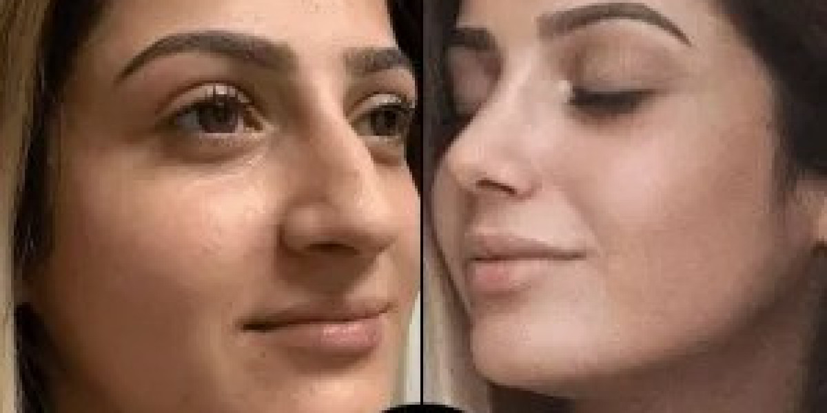 Top-Rated and Best Plastic Surgeons in Dubai for 2025