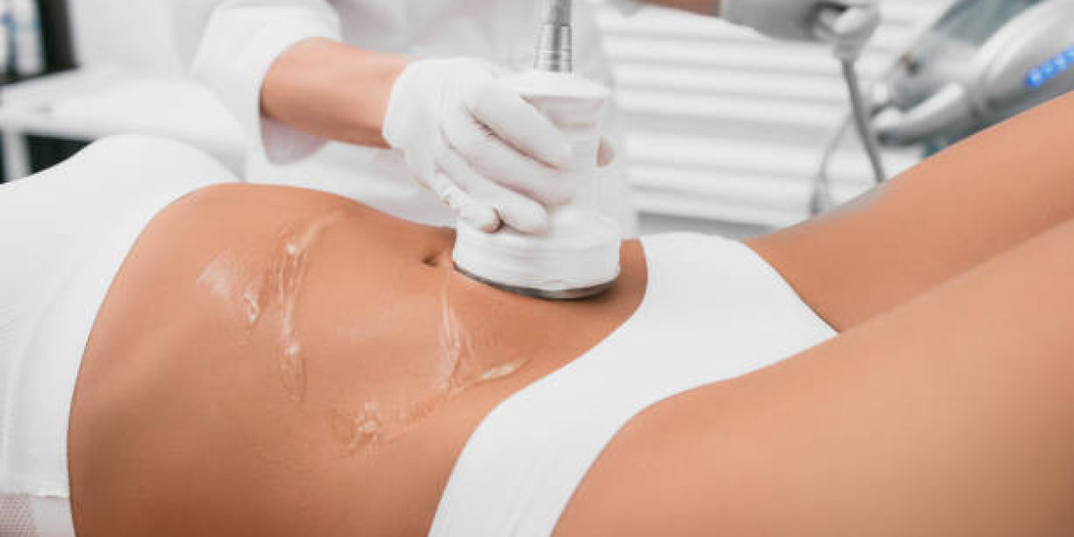 Liposuction for Men vs Women: What Are the Differences?
