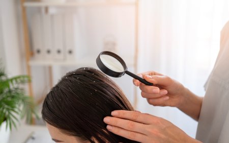 Best Shampoo for Dandruff and Hair Fall: Your Guide to Healthier Hair